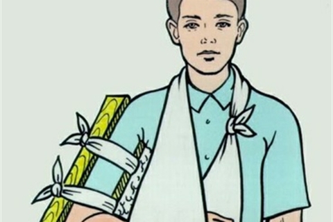 Kỹ thuật sơ cứu gãy xương